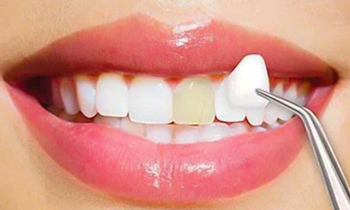 Enhance your smile at the top cosmetic dental clinic in Gurgaon, where you can get a complete smile design