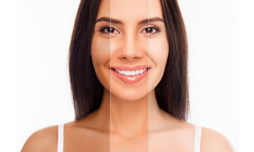 A brighter skin shade with the best skin whitening treatment in Gurgaon at Irvin Cosmetics